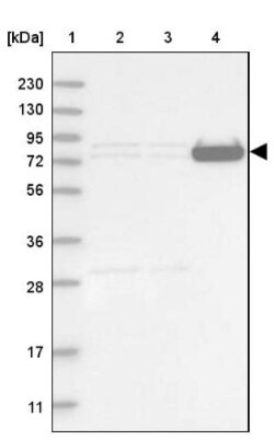 LRRC45 Antibody, Novus Biologicals 25 &mu;L | Buy Online | Novus Biologicals | Fisher Scientific