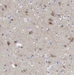 LRRC55 Antibody, Novus Biologicals 0.1mL; Unlabeled:Antibodies, Polyclonal