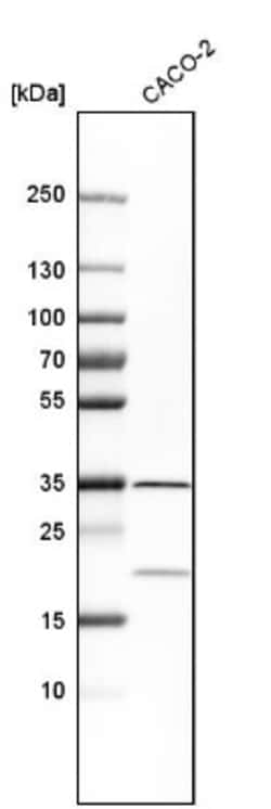 LRRC59 Antibody, Novus Biologicals:Antibodies:Primary Antibodies