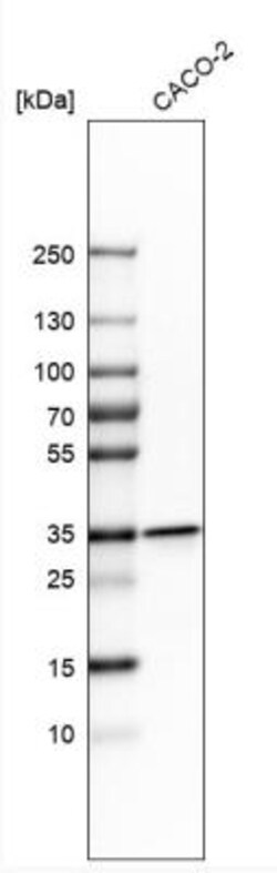 LRRC59 Antibody, Novus Biologicals 0.1mL; Unlabeled:Antibodies, Polyclonal