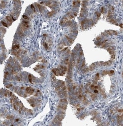 LRRC6 Antibody, Novus Biologicals 25 &mu;L | Buy Online | Novus Biologicals | Fisher Scientific