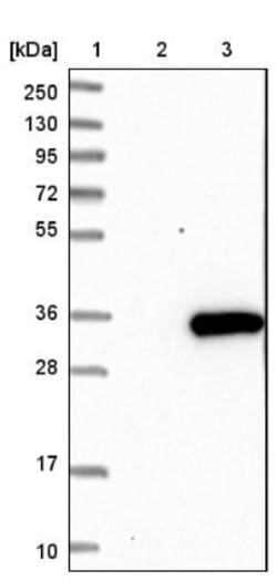 LRRC61 Antibody, Novus Biologicals:Antibodies:Primary Antibodies