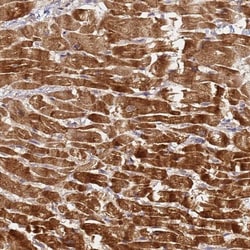 LRRC69 Antibody, Novus Biologicals 25ul | Buy Online | Novus Biologicals | Fisher Scientific