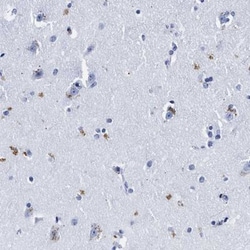 LRRC8E Antibody, Novus Biologicals 25 &mu;L | Buy Online | Novus Biologicals | Fisher Scientific