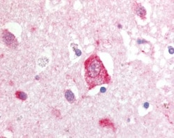 LRRK2 Antibody - BSA Free, Novus Biologicals 0.1mL; Unlabeled:Antibodies,