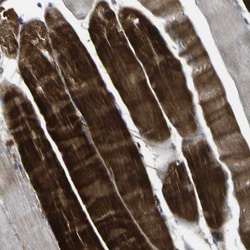 LRRN1/NLRR-1 Antibody, Novus Biologicals 0.1mL; Unlabeled:Antibodies, Polyclonal