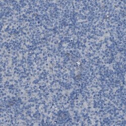 LRRN1/NLRR-1 Antibody, Novus Biologicals 0.1mL; Unlabeled:Antibodies, Polyclonal