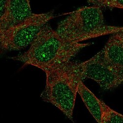 LRRN3/NLRR-3 Antibody, Novus Biologicals 25 &mu;L, Unlabeled:Antibodies,