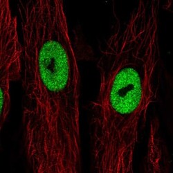LRRN4CL Antibody, Novus Biologicals 25 &mu;L, Unlabeled:Antibodies, Polyclonal
