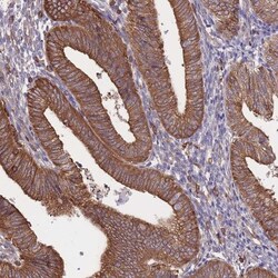 LRRN4CL Antibody, Novus Biologicals 25 &mu;L, Unlabeled:Antibodies, Polyclonal