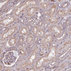 LRRN4CL Antibody, Novus Biologicals 25 &mu;L, Unlabeled:Antibodies, Polyclonal