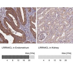 LRRN4CL Antibody, Novus Biologicals 25 &mu;L, Unlabeled:Antibodies, Polyclonal