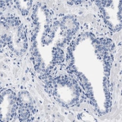 LRWD1 Antibody, Novus Biologicals:Antibodies:Primary Antibodies