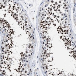LRWD1 Antibody, Novus Biologicals:Antibodies:Primary Antibodies