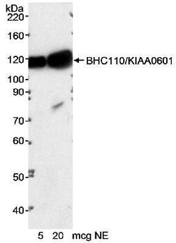 LSD1 Antibody, Novus Biologicals 0.1mg; Unlabeled:Antibodies, Polyclonal