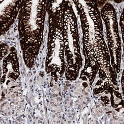 LSM11 Antibody, Novus Biologicals 0.1mL; Unlabeled:Antibodies, Polyclonal