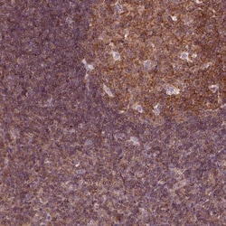 LSM14A Antibody, Novus Biologicals 0.1mL; Unlabeled:Antibodies, Polyclonal