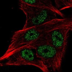LSM2 Antibody, Novus Biologicals 0.1mL; Unlabeled:Antibodies, Polyclonal