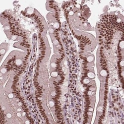 LSM2 Antibody, Novus Biologicals 0.1mL; Unlabeled:Antibodies, Polyclonal