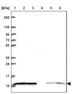LSM2 Antibody, Novus Biologicals 0.1mL; Unlabeled:Antibodies, Polyclonal