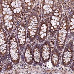 LSM4 Antibody, Novus Biologicals 25 &mu;L; Unlabeled:Antibodies, Polyclonal