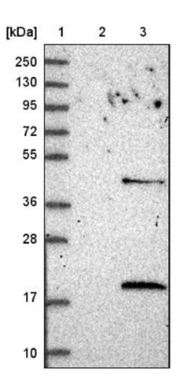 LSM4 Antibody, Novus Biologicals 25 &mu;L; Unlabeled:Antibodies, Polyclonal