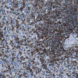 RAB32 Antibody, Novus Biologicals:Antibodies:Primary Antibodies