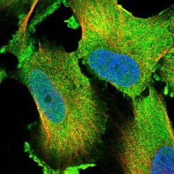 PSTPIP2 Antibody, Novus Biologicals:Antibodies:Primary Antibodies