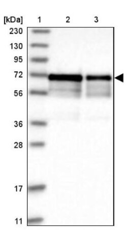 LTV1 Antibody, Novus Biologicals 25 &mu;L; Unlabeled:Antibodies, Polyclonal