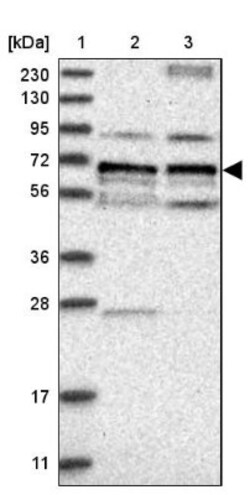 PSTPIP2 Antibody, Novus Biologicals:Antibodies:Primary Antibodies