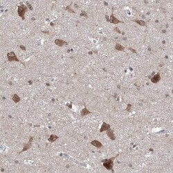 LURAP1 Antibody, Novus Biologicals 0.1mL; Unlabeled:Antibodies, Polyclonal