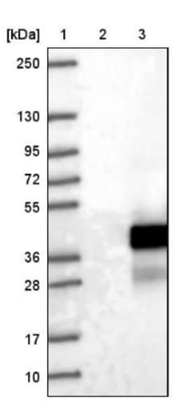 LURAP1 Antibody, Novus Biologicals 0.1mL; Unlabeled:Antibodies, Polyclonal