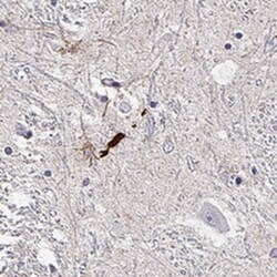 LUZP2 Antibody, Novus Biologicals:Antibodies:Primary Antibodies