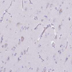 LUZP4 Antibody, Novus Biologicals 25 &mu;L, Unlabeled:Antibodies, Polyclonal