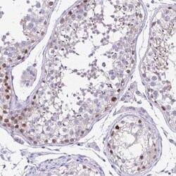 LUZP4 Antibody, Novus Biologicals 25 &mu;L, Unlabeled:Antibodies, Polyclonal