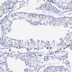 LUZP4 Antibody, Novus Biologicals:Antibodies:Primary Antibodies