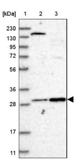 LXR alpha/NR1H3 Antibody, Novus Biologicals 25 &mu;L, Unconjugated:Antibodies,