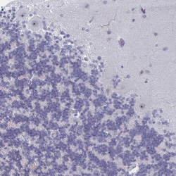 LXR beta/NR1H2 Antibody, Novus Biologicals 25 &mu;L, Unlabeled:Antibodies,