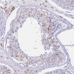 LYAG/GAA Antibody, Novus Biologicals:Antibodies:Primary Antibodies