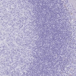 LYAG/GAA Antibody, Novus Biologicals:Antibodies:Primary Antibodies