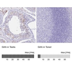LYAG/GAA Antibody, Novus Biologicals:Antibodies:Primary Antibodies