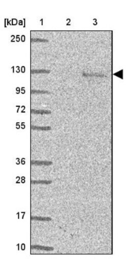 LYAG/GAA Antibody, Novus Biologicals:Antibodies:Primary Antibodies