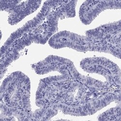 MTO1 Antibody, Novus Biologicals:Antibodies:Primary Antibodies