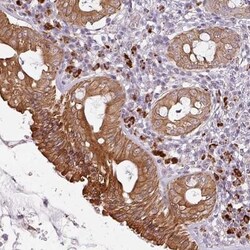LYPLA1 Antibody, Novus Biologicals 0.1mL; Unlabeled:Antibodies, Polyclonal