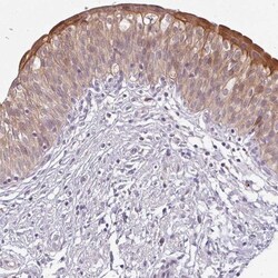LYPLA1 Antibody, Novus Biologicals 0.1mL; Unlabeled:Antibodies, Polyclonal