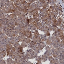 LYPLA3 Antibody, Novus Biologicals 25 &mu;L | Buy Online | Novus Biologicals | Fisher Scientific
