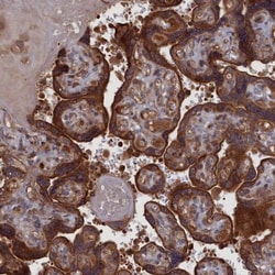 LYPLA3 Antibody, Novus Biologicals 25 &mu;L | Buy Online | Novus Biologicals | Fisher Scientific