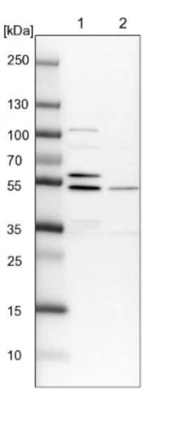 LYPLA3 Antibody, Novus Biologicals 25 &mu;L | Buy Online | Novus Biologicals | Fisher Scientific