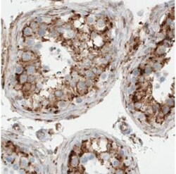 LYRIC Antibody (CL0401), Novus Biologicals:Antibodies:Primary Antibodies