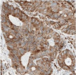 LYRIC Antibody (CL0401), Novus Biologicals:Antibodies:Primary Antibodies